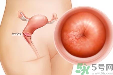 陰道干澀的原因是什么？陰道干澀怎么辦？