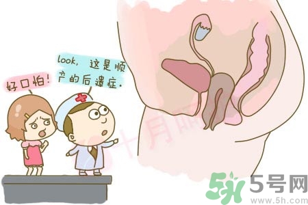 陰道松弛有什么危害？?陰道松弛恢復(fù)的方法有哪些？