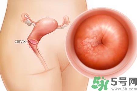 陰道出血和什么有關(guān)？陰道出血的應急措施有哪些？