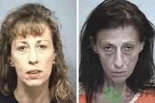 抗衰老的癥狀有哪些？抗衰老的表現(xiàn)是什么？