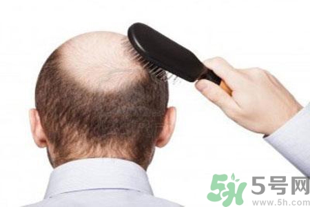 男性衰老的征兆有哪些？男性10個難以逆轉(zhuǎn)的衰老征兆