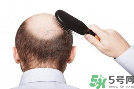 男性防止性衰老決竅有哪些？男性受用一生抵抗衰老法則