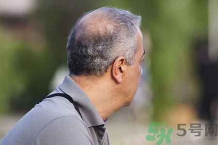 男性更年期的表現(xiàn)有哪些？怎么判斷男性更年期？