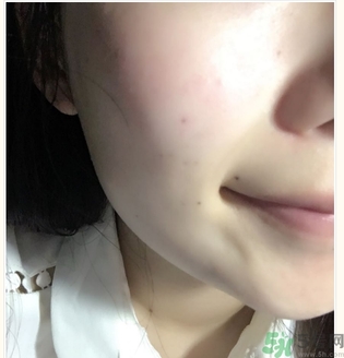 麗得姿面膜適合孕婦可以用嗎？麗得姿面膜哪些孕婦可以用？