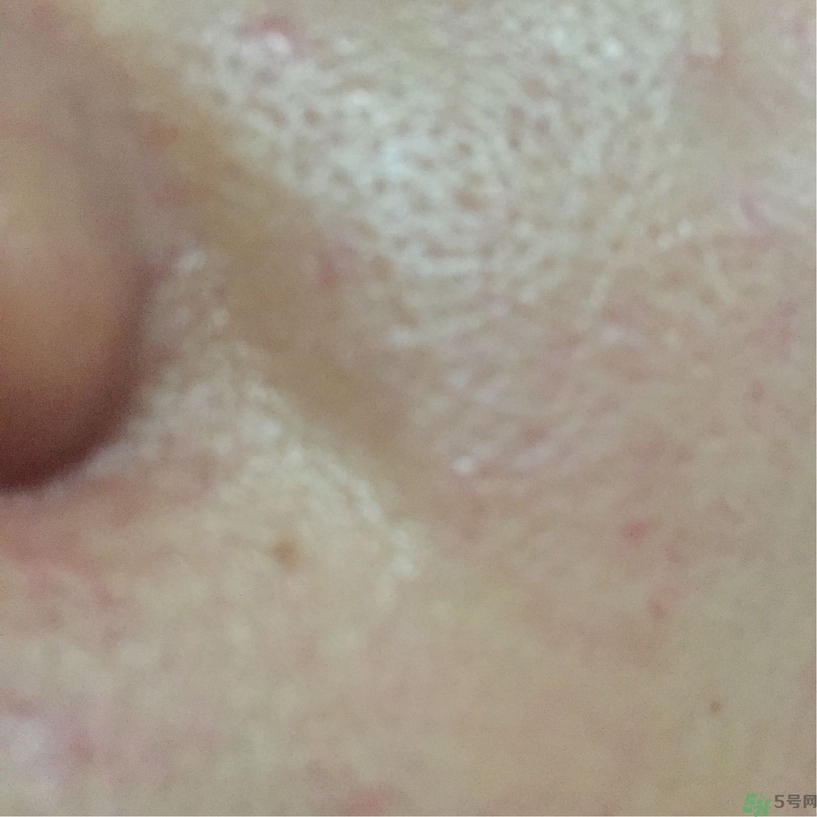 美即水光盈金縷梅面膜多少錢?美即水光盈金縷梅面膜價(jià)格 美即水光盈金縷梅面膜多少錢?美即水光盈金縷梅面膜價(jià)格