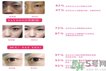 自然之名雪玫瑰雪蒸汽眼霜適合什么年齡？自然之名雪玫瑰雪蒸汽眼霜價(jià)格多少？