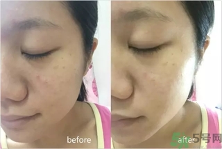 rilastil面膜使用方法 維納斯蒂爾面膜怎么用？