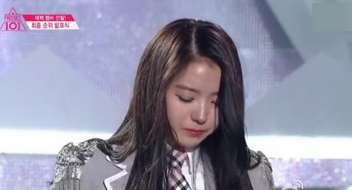 任娜英鼻子塌陷 整容鼻子容易塌陷嗎？