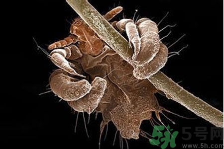 引起外陰瘙癢的疾病有哪些？治療外陰瘙癢的偏方有哪些？