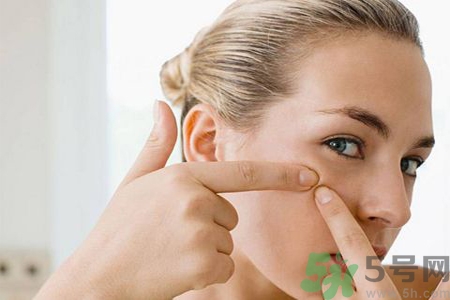 太陽穴長痘是怎么回事？太陽穴長痘的原因是什么？