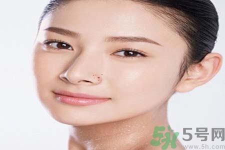 太陽(yáng)穴長(zhǎng)痘怎么辦？如何祛除太陽(yáng)穴上的痘痘？