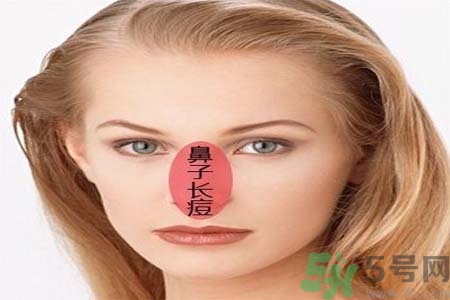 鼻翼長(zhǎng)痘痘怎么辦？鼻翼長(zhǎng)痘解決方法有哪些？