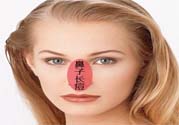 鼻翼長(zhǎng)痘痘怎么回事？鼻翼長(zhǎng)痘痘的原因是什么？