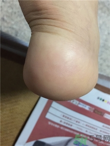 爽健scholl絲柔電動(dòng)修足機(jī)好用嗎?爽健scholl絲柔電動(dòng)修足機(jī)怎么樣? 爽健scholl絲柔電動(dòng)修足機(jī)好用嗎?爽健scholl絲柔電動(dòng)修足機(jī)怎么樣?