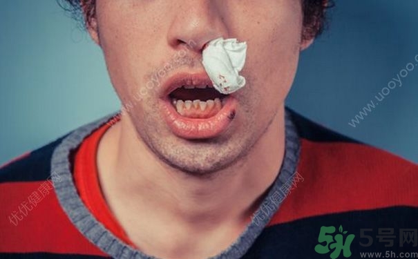 15歲男孩可以刮胡子嗎？15歲男孩經(jīng)常流鼻血怎么回事？