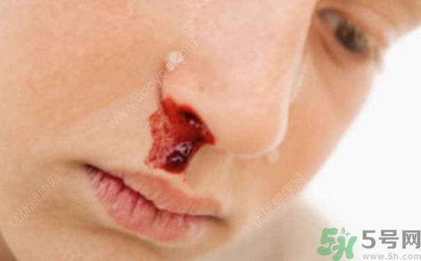 15歲男孩可以刮胡子嗎？15歲男孩經(jīng)常流鼻血怎么回事？