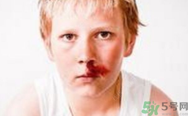 15歲男孩可以刮胡子嗎？15歲男孩經(jīng)常流鼻血怎么回事？