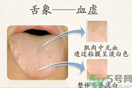 血虛的癥狀是什么？血虛的表現(xiàn)有哪些？