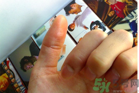 腳上長雞眼是怎么回事？腳上長雞眼是怎么辦？