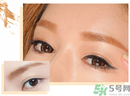 切眉后多久恢復(fù)自然？切眉術(shù)后面部淤青多久才能消？