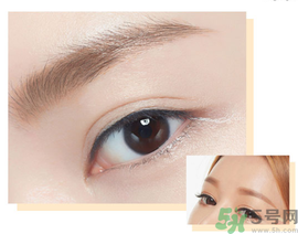 切眉后多久恢復(fù)自然？切眉術(shù)后面部淤青多久才能消？