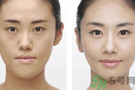 激光縮毛孔多少錢一次？激光縮毛孔一個(gè)療程多少錢？