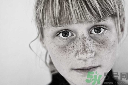 臉上長雀斑吃什么好？有雀斑不能吃什么？