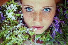 臉上長雀斑吃什么好？有雀斑不能吃什么？