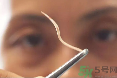 魚刺卡在喉嚨里怎么辦？取魚刺的小技巧有哪些？