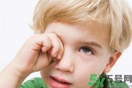 流行性腮腺炎的表現(xiàn)有哪些？?流行性腮腺炎飲食怎么調(diào)理？