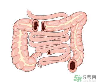 腸炎肚子疼怎么辦？腸炎肚子疼怎么緩解？