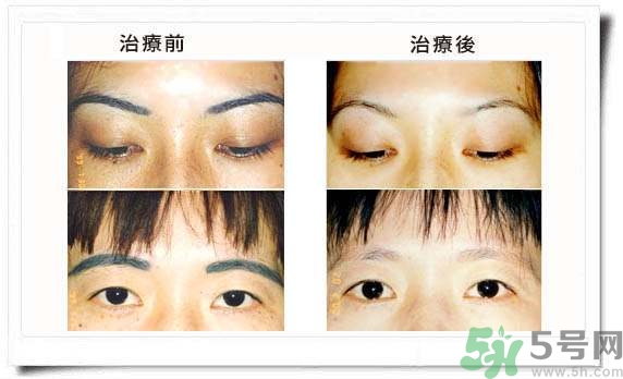 紋眉毛有什么危害？紋眉后注意事項