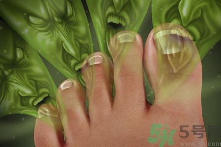 怎么治腳臭？腳臭的原因是什么？