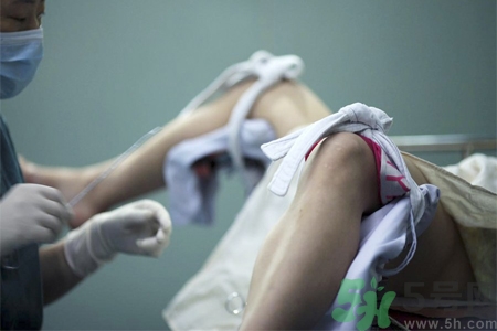 處女膜修補術(shù)是什么？處女膜修補術(shù)恢復(fù)時間要多久？