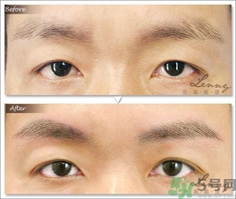 眉毛怎么整形好看？眉毛怎么整自然？