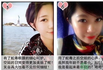 蛇毒眼膜孕婦可以用嗎？ 日本spa蛇毒眼膜孕婦能用嗎？