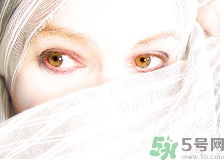 散光和近視的區(qū)別 散光的癥狀有哪些？