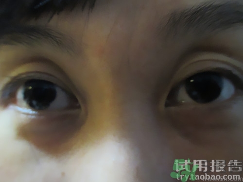 蛇毒眼膜效果怎么樣？spa蛇毒眼膜紅色好用嗎？