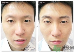 眉毛怎么整形好看？眉毛怎么整自然？