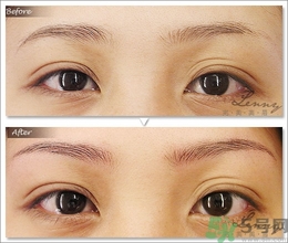 眉毛怎么整形好看？眉毛怎么整自然？