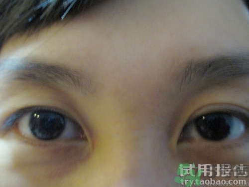 蛇毒眼膜效果怎么樣？spa蛇毒眼膜紅色好用嗎？