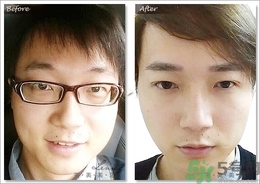 眉毛怎么整形好看？眉毛怎么整自然？