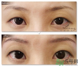 眉毛怎么整形好看？眉毛怎么整自然？