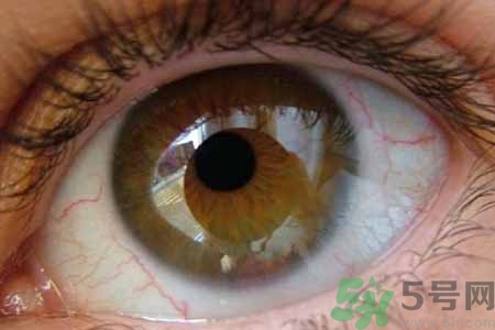 ?干眼癥的治療方法是什么？如何預(yù)防干眼癥？