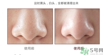 yu.r巧克力棒鼻貼怎么樣？yu.r巧克力鼻貼好用嗎？