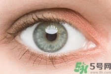 黑眼圈是怎么形成的？黑眼圈是什么原因引起的？