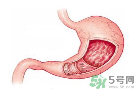 緩解胃脹的方法是什么？胃脹可以吃什么？