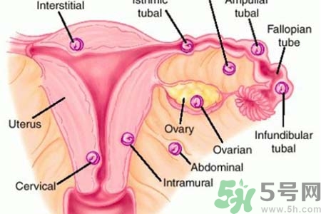 宮外孕手術(shù)后吃什么好？宮外孕手術(shù)后需要注意什么？
