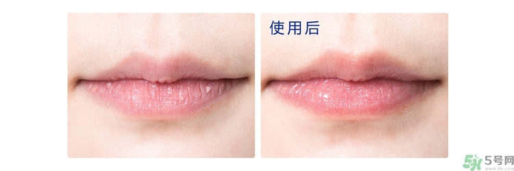 碧唇小藍(lán)罐唇膏孕婦可以用嗎？blistex碧唇小藍(lán)罐專柜價(jià)格