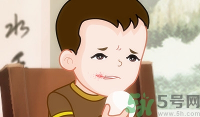 寶寶爛嘴角怎么辦？寶寶爛嘴角的治療方法